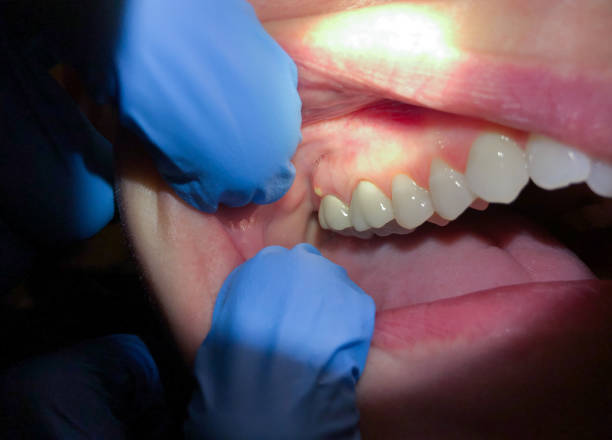 Best Cosmetic Emergency Dentistry in Clarendon Hls, IL