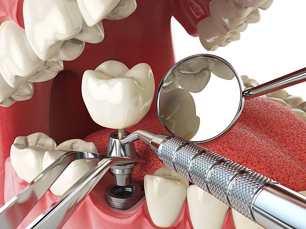 Best Emergency TMJ Treatment in Clarendon Hls, IL